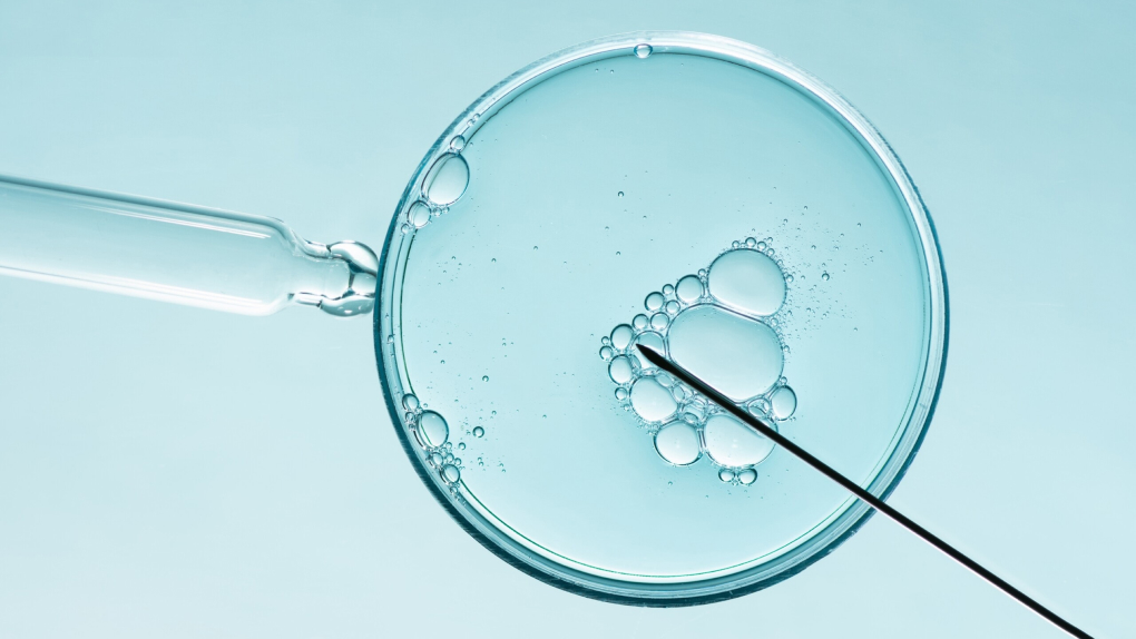 Preimplantacijski genetski skrining